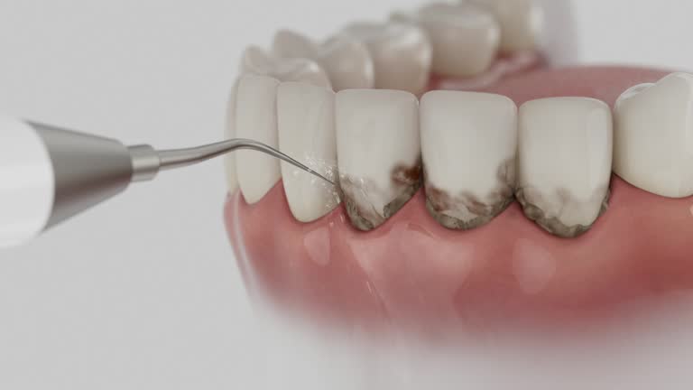 Reliable Invisalign Clear Aligners contractor in Grant, NE by Smile Center Dentistry